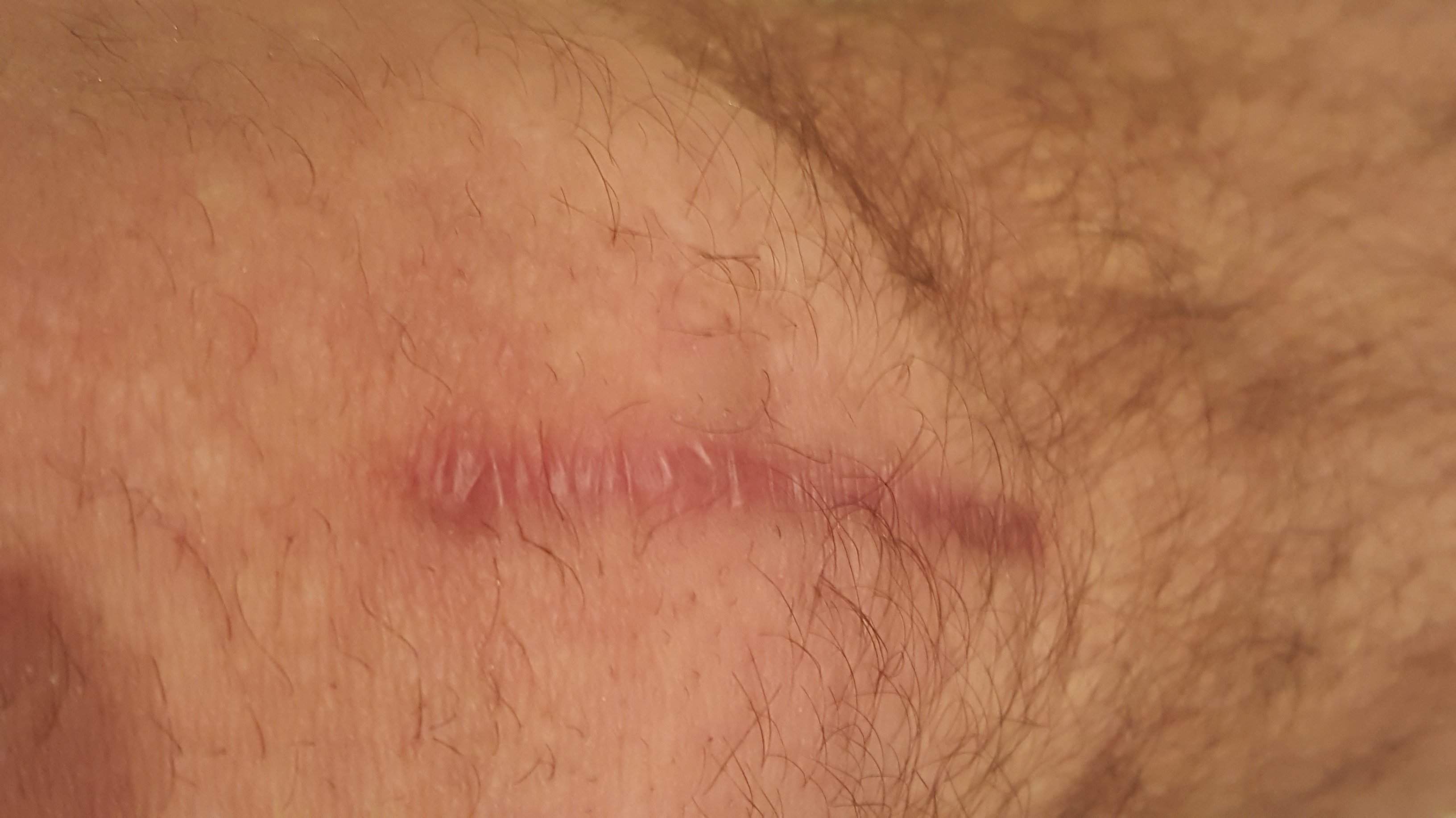 20170203_203731.jpg