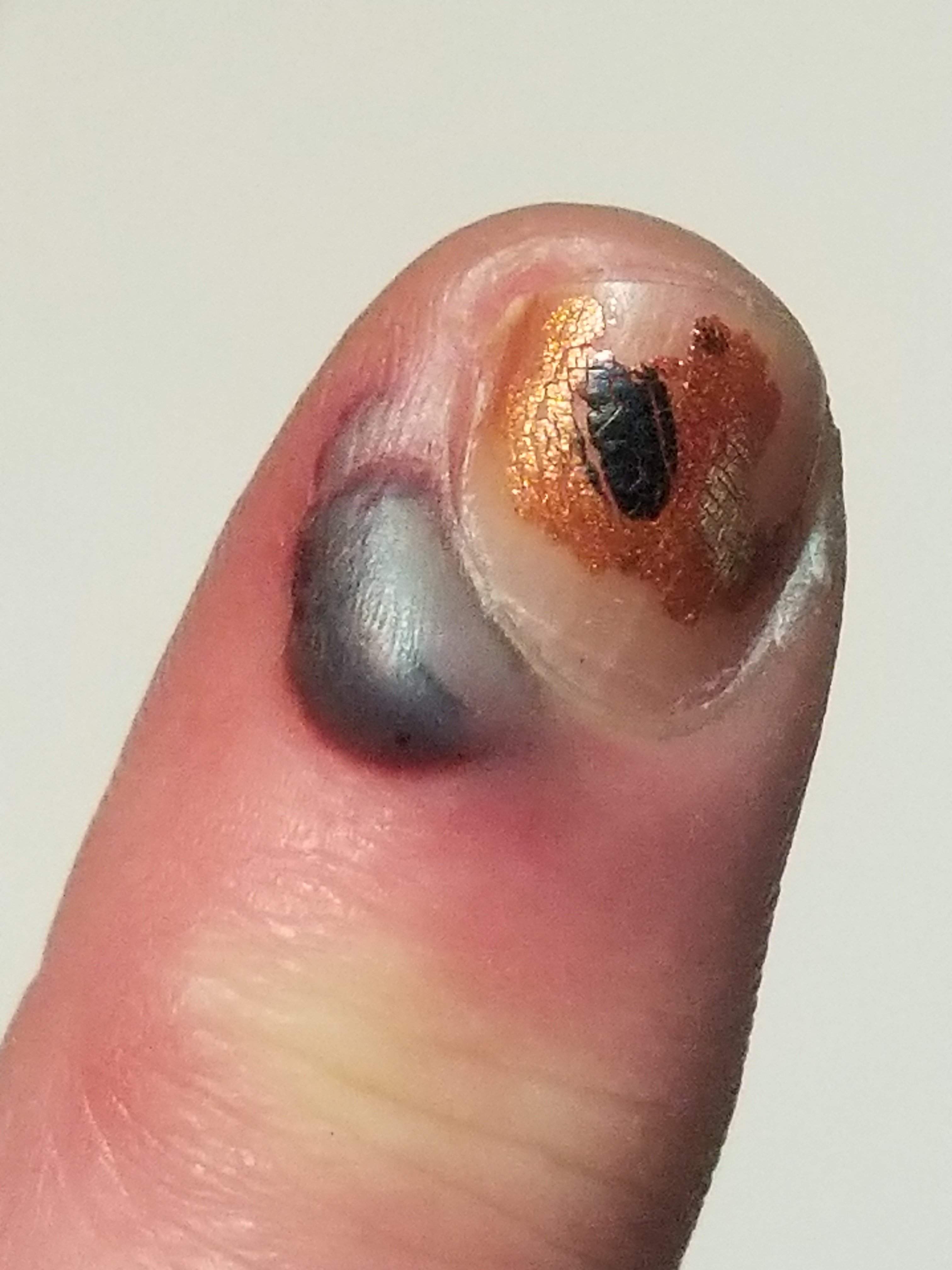 20180228_223139.jpg
