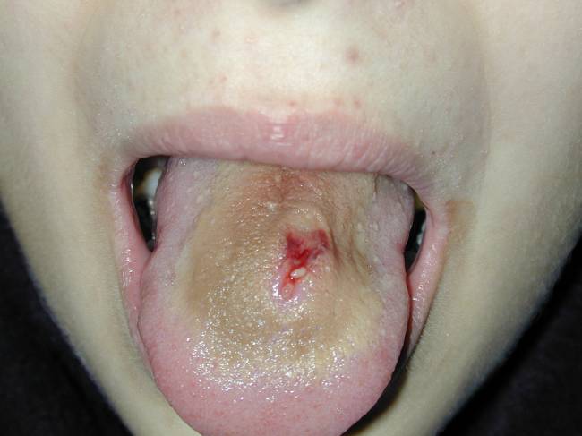 6DSCN3057.jpg