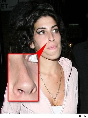 amy_winehouse_nose.jpg