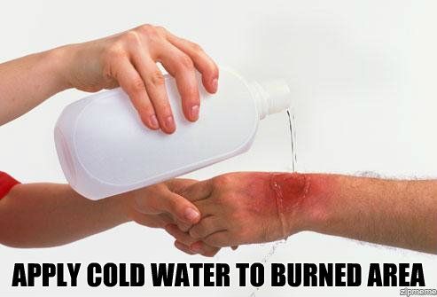 Apply_cold_water_to_burned_area.jpg