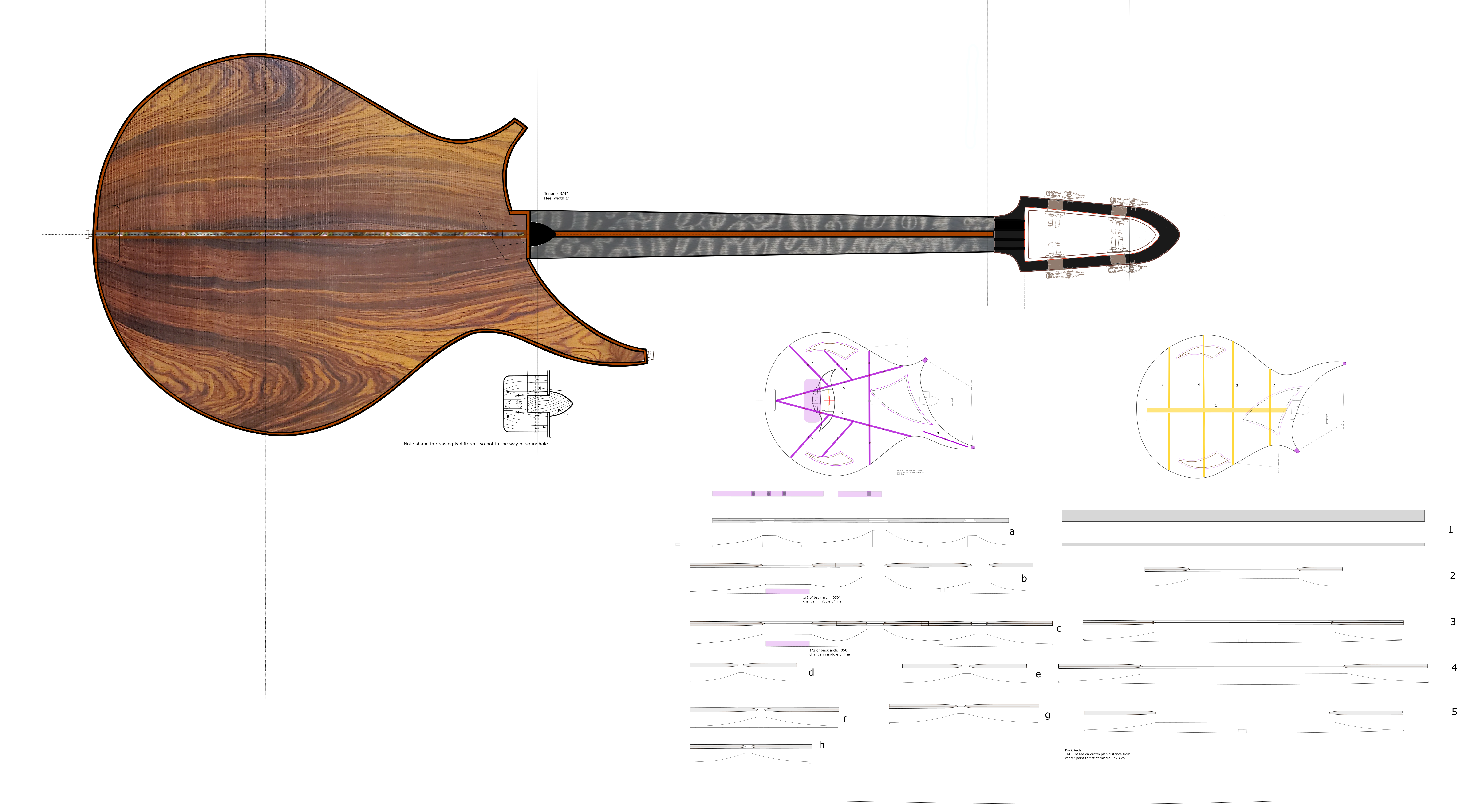 Back View and braces.png