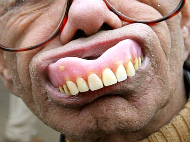bad-dentures.jpg