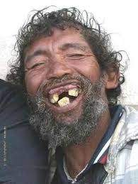 bad teeth.jpg