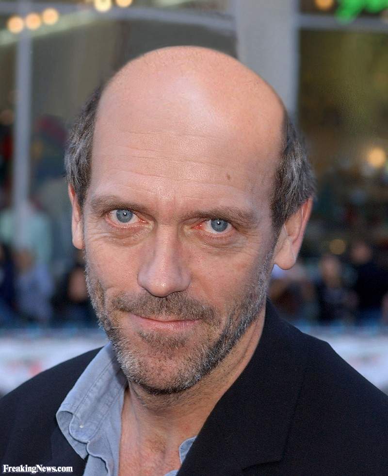 Bald-Dr-House--71283.jpg