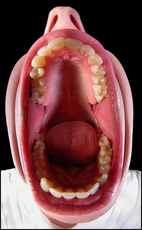 bigmouth.jpg