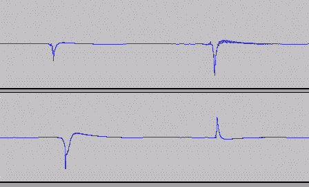 blips.gif