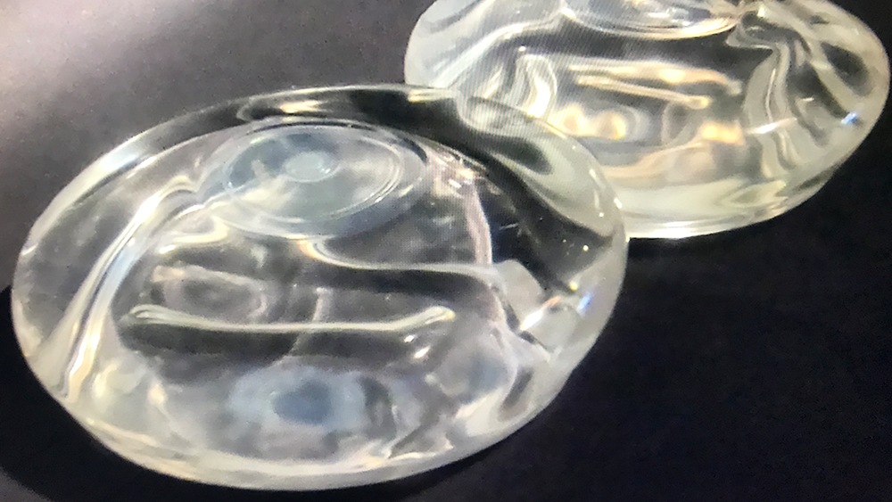 breast-implants-generic-matt-mcglashen.png