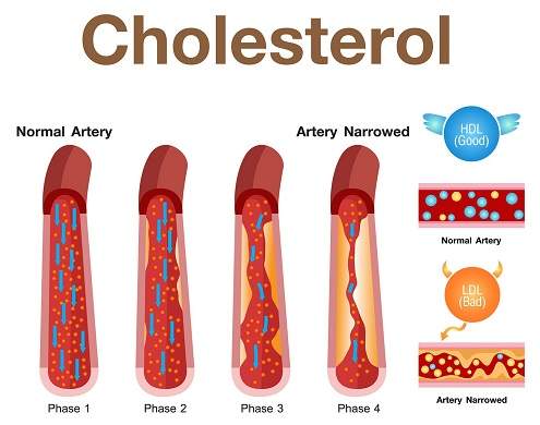 CHOLESTEROL.jpg