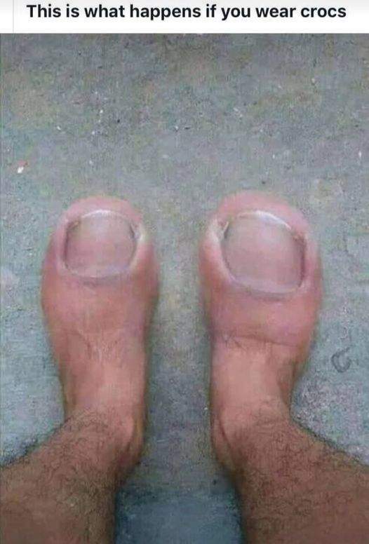 CROCS.JPG