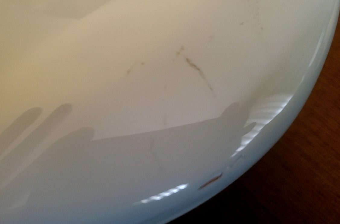 dents.png