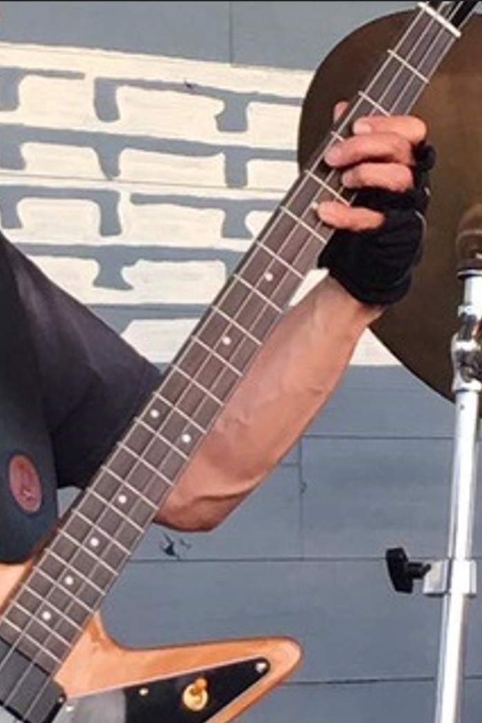 EpiExpNeck.jpg