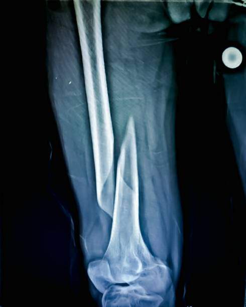 Evil Knee-vil.jpg
