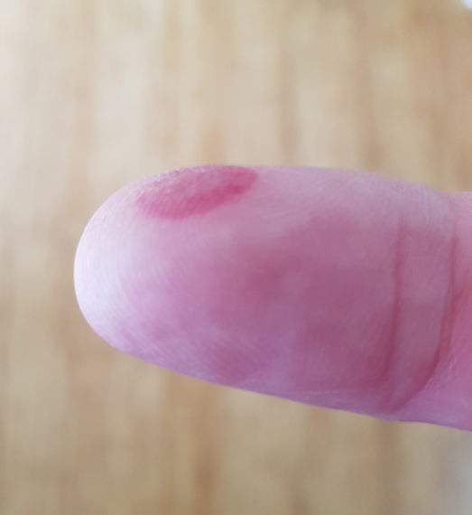 finger.jpg