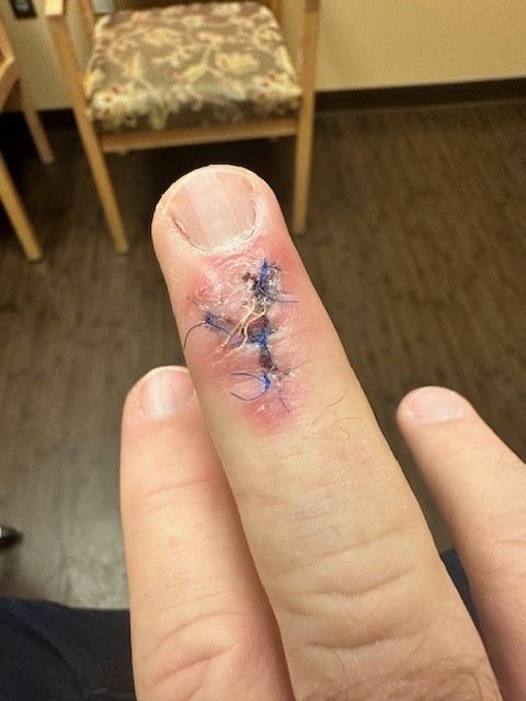 Finger.jpg