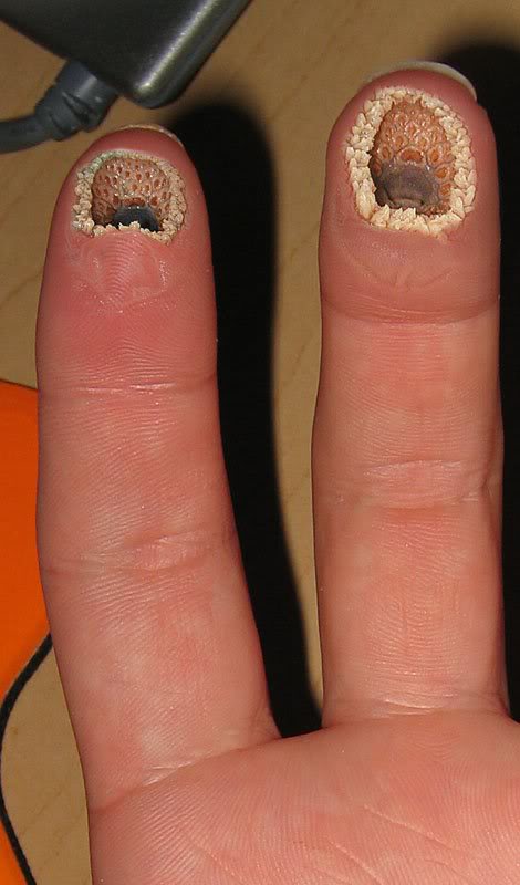 fingerps.jpg