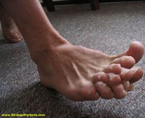 gnarly feet.jpg