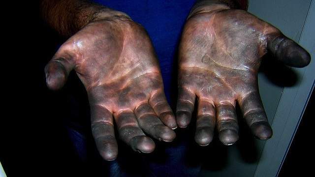 greasy-hands-4.jpg