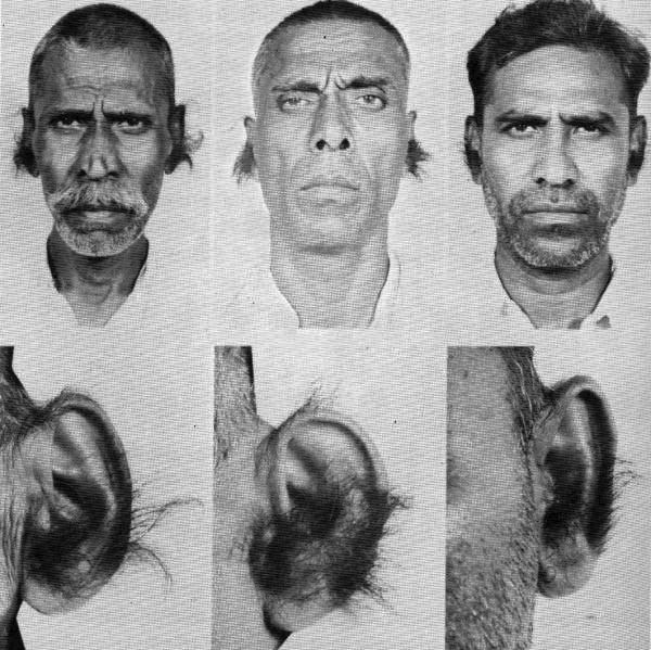 Hairy_Ears.jpg