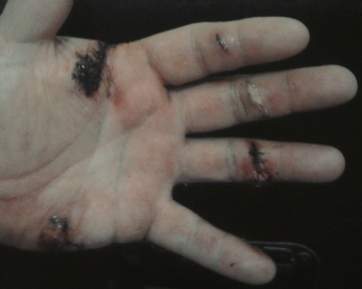 hand.jpg
