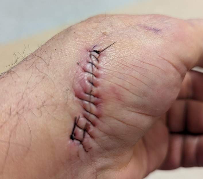 hand3.jpg