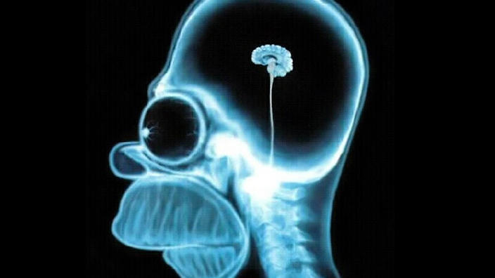 homer_brain_scan.jpg
