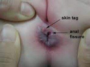 images.jpg