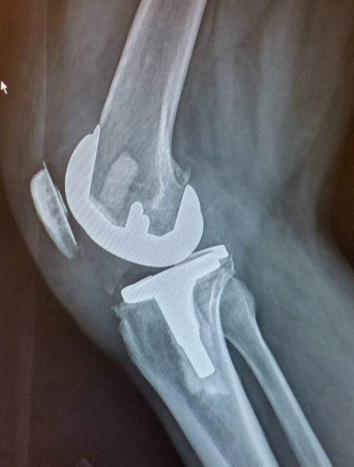 Knee Joint.jpg