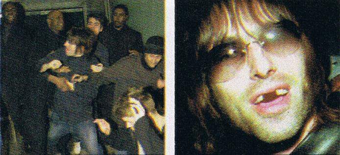 Liam+Gallagher+Munich+fight+teeth.jpg