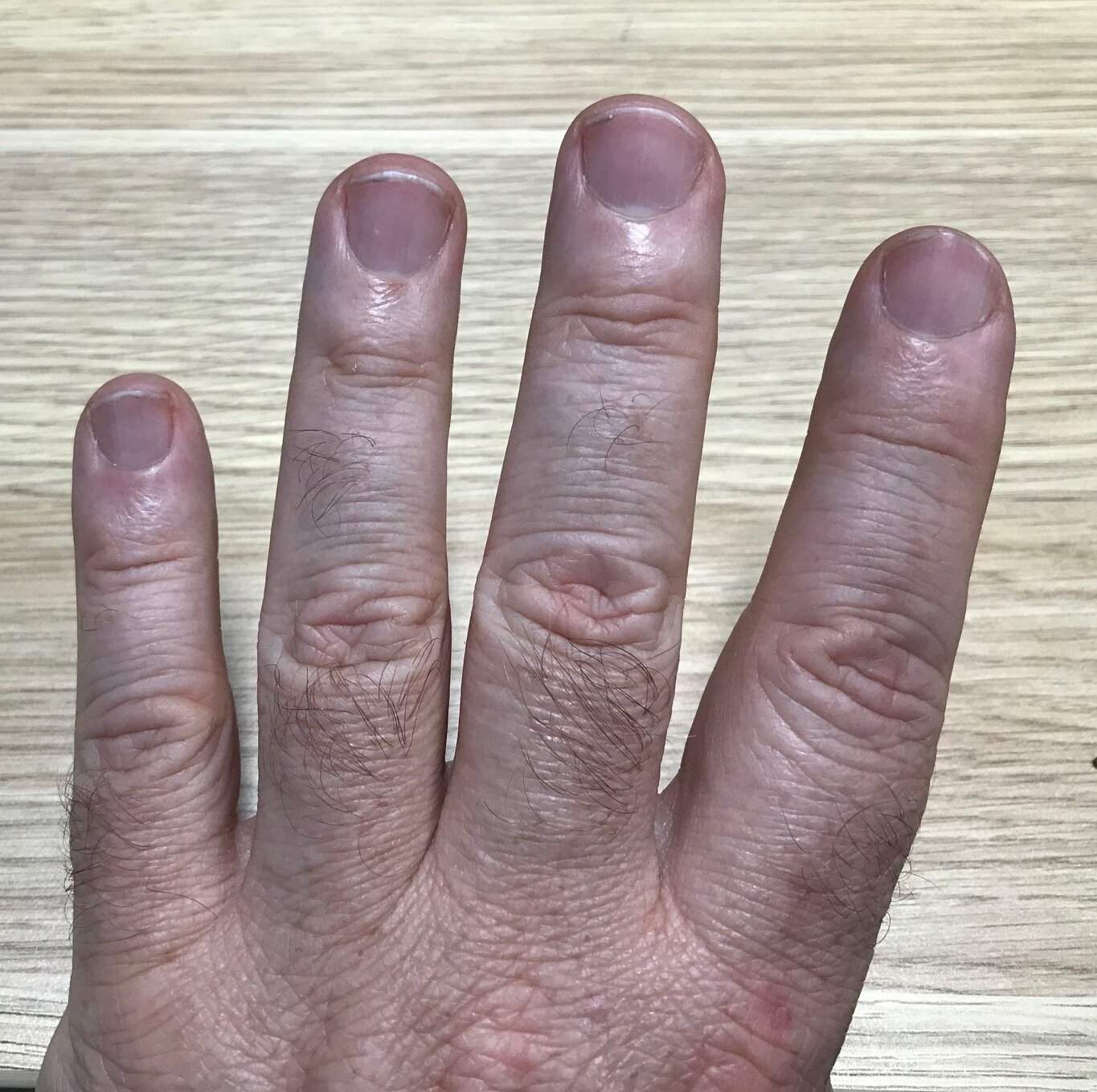 Nail length.jpg