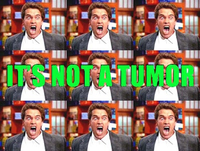 not%2Ba%2Btumor.jpg