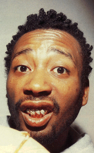 odb.jpg
