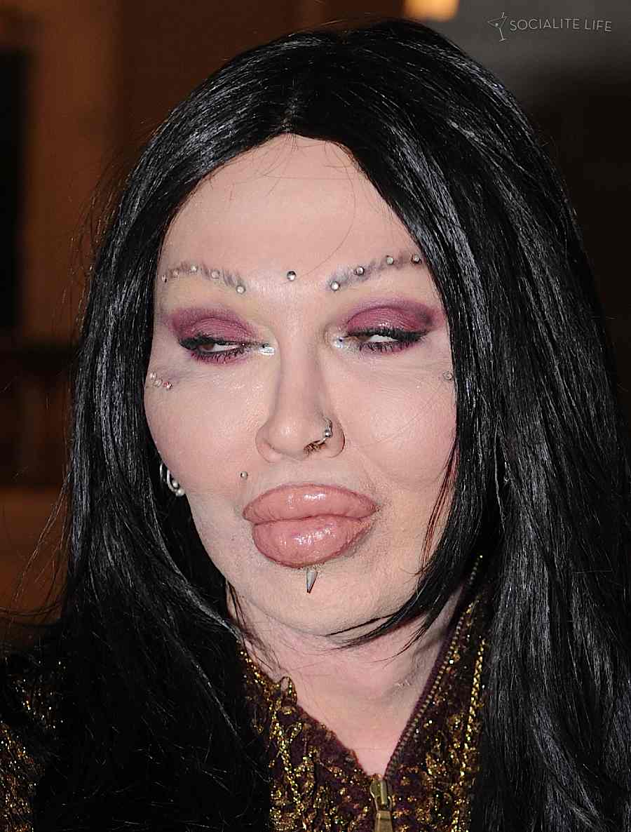 pete-burns-after.jpg