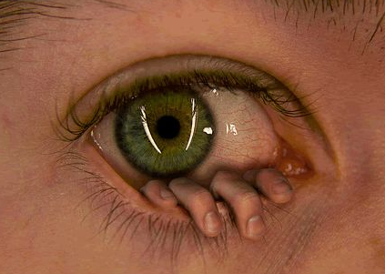 pokeintheeye.png