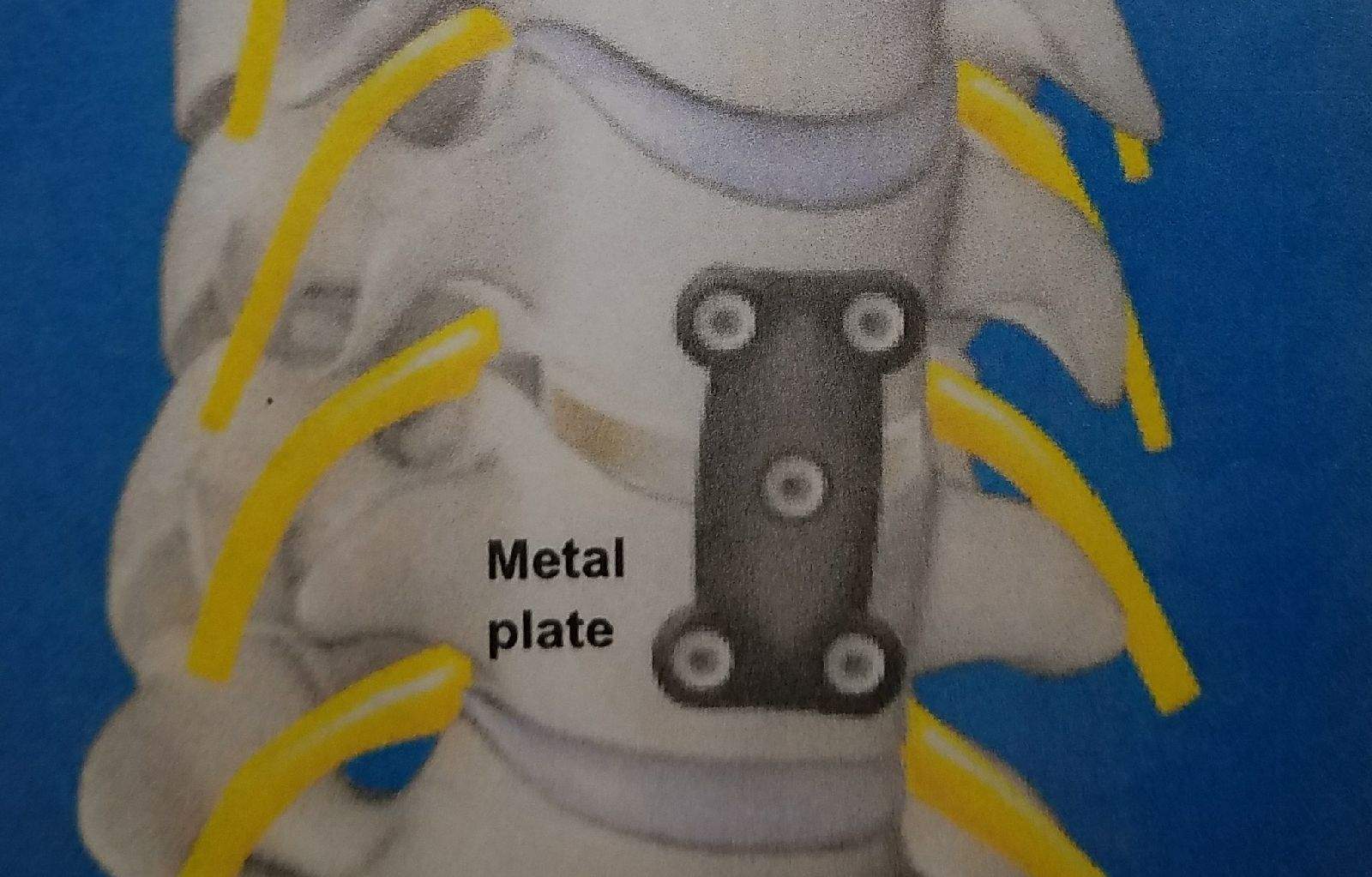 PreSurg2.jpeg