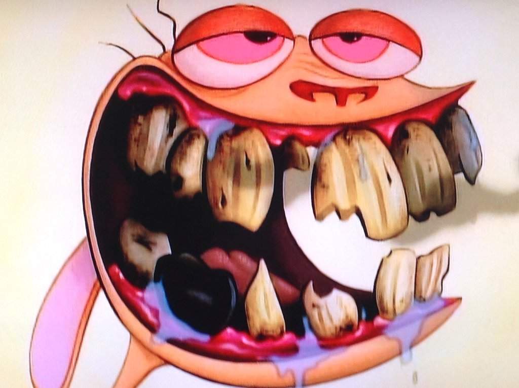 ren bad teeth.jpg