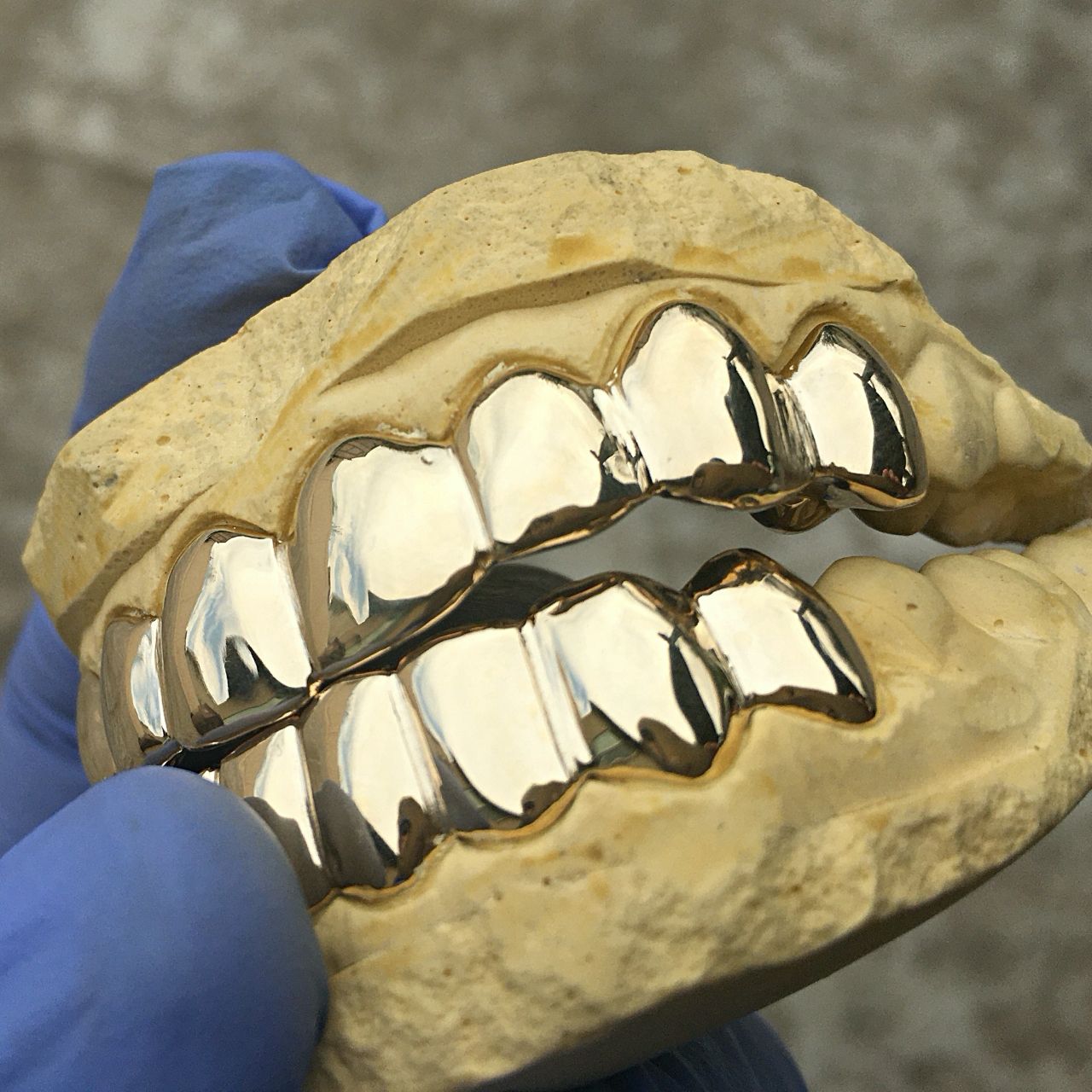 solid-gold-custom-grillz-223_2000x.jpg