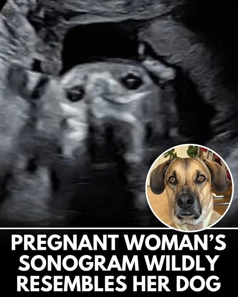 sonogram.jpg