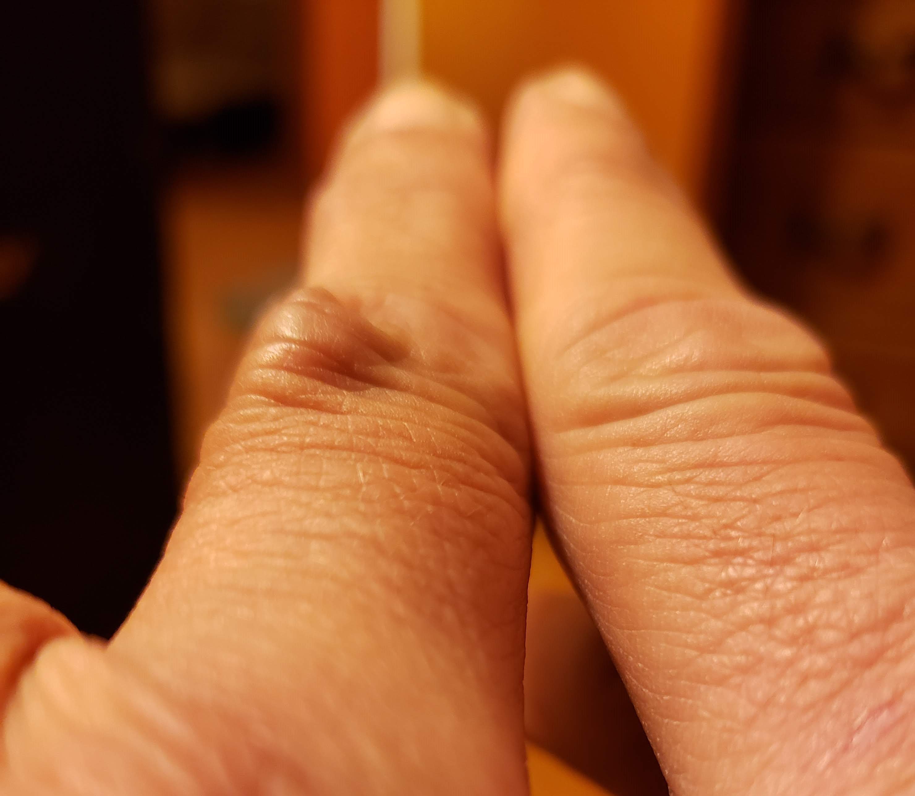 tendon.jpg