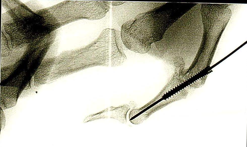THUMB SCREW.jpg