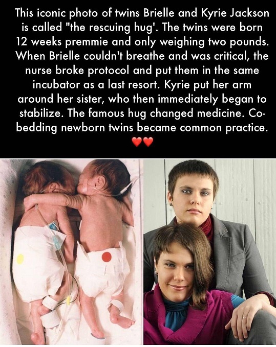 twins amazing.jpg