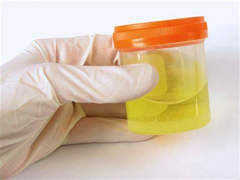 urine.jpeg