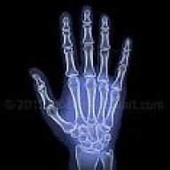 brokenfinger