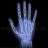 brokenfinger