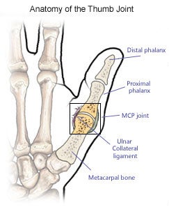 thumb-mcp-joint-jpg.46720